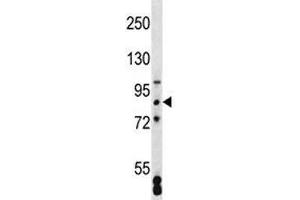 SATB2 antibody western blot analysis in MCF-7 lysate (SATB2 Antikörper  (AA 410-439))