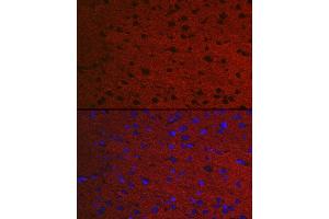 Immunofluorescence analysis of Rat brain using RA antibody (ABIN7269809) at dilution of 1:50. (RAB3A Antikörper  (AA 100-200))