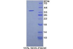 SDS-PAGE analysis of Mouse Sirtuin 6 Protein. (SIRT6 Protein)
