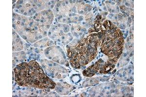 Immunohistochemical staining of paraffin-embedded Kidney tissue using anti-TUBA8 mouse monoclonal antibody.