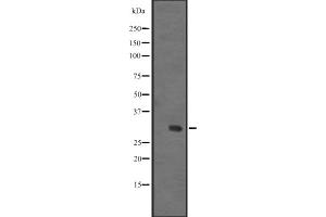 Western blot analysis of IGFBPL1 expression in Human fetal liver lysate ,The lane on the left is treated with the antigen-specific peptide.