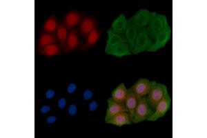 ABIN6261789 and ABIN6266775 staining Hela cells(45 min of heat-shock) by IF/ICC. (FOXH1 Antikörper  (Internal Region))