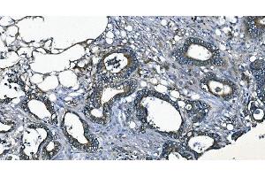 IHC analysis of EEF2/Elongation factor 2 using anti-EEF2/Elongation factor 2 antibody (ABIN7603142).