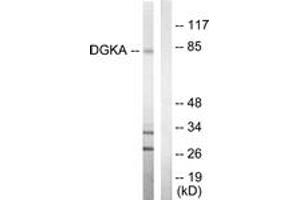 Western blot analysis of extracts from Jurkat cells, using DGKA Antibody. (DGKA Antikörper  (AA 304-353))