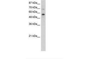 Image no. 1 for anti-Zinc Finger Protein 71 (ZNF71) (N-Term) antibody (ABIN6736258) (ZNF71 Antikörper  (N-Term))