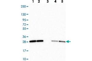 Western blot analysis of Lane 1: Human cell line RT-4 Lane 2: Human cell line U-251MG sp Lane 3: Human plasma (IgG/HSA depleted) Lane 4: Human liver tissue Lane 5: Human tonsil tissue with RBL1 polyclonal antibody  at 1:250-1:500 dilution. (p107 Antikörper)