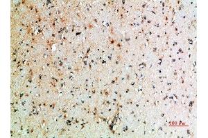 Immunohistochemical analysis of paraffin-embedded human-brain, antibody was diluted at 1:200 (CTLA4 Antikörper  (AA 41-90))