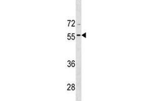 BMP8A antibody western blot analysis in CEM lysate (BMP8A Antikörper  (AA 271-298))