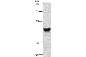 Western blot analysis of Human esophagus cancer tissue, using KRT13 Polyclonal Antibody at dilution of 1:500 (Cytokeratin 13 Antikörper)