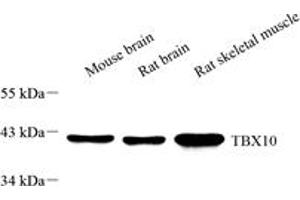 Western blot analysis of TBX10 (ABIN7075814),at dilution of 1: 1000,Lane 1: Mouse brain tissue lysate,Lane 2: Rat brain tissue lysate,Lane 3: Rat skeletal muscle tissue lysate (T-Box 10 Antikörper)