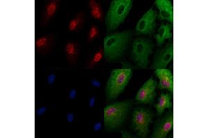 ABIN6262731 and ABIN6266953 staining  cells by IF/ICC. (TAF9 Antikörper  (Internal Region))