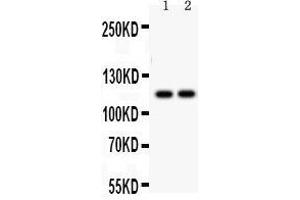 Western Blotting (WB) image for anti-ATPase, Ca++ Transporting, Ubiquitous (ATP2A3) (AA 1-30), (N-Term) antibody (ABIN3043794) (ATP2A3 Antikörper  (N-Term))