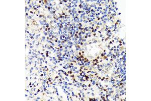 Immunohistochemistry of paraffin-embedded human appendix using P Rabbit mAb (ABIN7269154) at dilution of 1:100 (40x lens). (PAX5 Antikörper)
