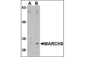 Western blot analysis of MARCH8 in HeLa cell lysate with MARCH8 antibody at (A) 0. (MARCH8 Antikörper  (C-Term))