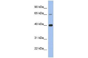 WB Suggested Anti-ESR1 Antibody Titration:  0. (Estrogen Receptor alpha Antikörper  (C-Term))