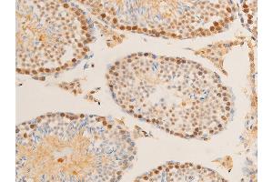Immunohistochemistry (IHC) image for anti-Myc Proto-Oncogene protein (MYC) (pSer62) antibody (ABIN6255431)