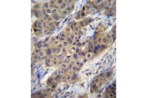 Immunohistochemistry (IHC) image for anti-Transforming Growth Factor, beta 1 (TGFB1) (AA 22-50), (N-Term) antibody (ABIN5532245)