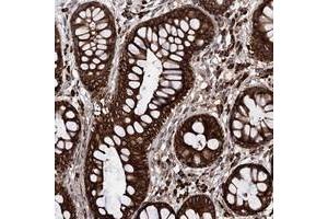 Immunohistochemical staining of human rectum with CDAN1 polyclonal antibody  shows strong cytoplasmic and membranous positivity in glandular cells. (Codanin 1 (CDNA1) Antikörper)