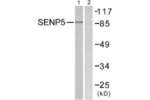 Western Blotting (WB) image for anti-SUMO1/sentrin Specific Peptidase 5 (SENP5) (C-Term) antibody (ABIN1848845) (SENP5 Antikörper  (C-Term))
