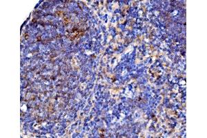 IHC analysis of Cd38 using anti-Cd38 antibody (ABIN7602864).