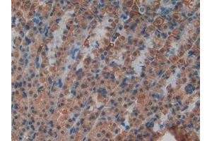 Detection of ND5 in Rat Stomach Tissue using Polyclonal Antibody to NADH Dehydrogenase 5 (ND5) (MT-ND5 Antikörper  (AA 425-562))