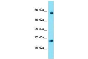 Host: Rabbit  Target Name: Ap1s1  Sample Tissue: Mouse Heart lysates  Antibody Dilution: 1. (AP1S1 Antikörper  (C-Term))