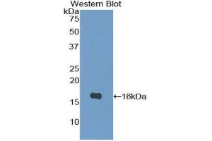 Western blot analysis of the recombinant protein. (IL-4 Antikörper  (AA 25-133))