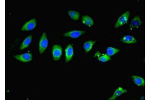 Immunofluorescent analysis of A549 cells using ABIN7146905 at dilution of 1:100 and Alexa Fluor 488-congugated AffiniPure Goat Anti-Rabbit IgG(H+L) (CARD1 (AA 863-1032) Antikörper)