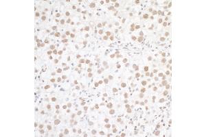 Immunohistochemistry (IHC) image for anti-Wilms Tumor 1 Associated Protein (WTAP) (AA 346-396) antibody (ABIN7453489) (WTAP Antikörper  (AA 346-396))