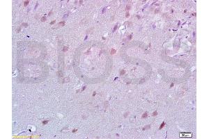 Formalin-fixed and paraffin embedded rat brain tissue labeled with Anti-Lingo-1 Polyclonal Antibody, Unconjugated (ABIN738801) at 1:200 followed by conjugation to the secondary antibody and DAB staining (LINGO1 Antikörper  (AA 521-620))