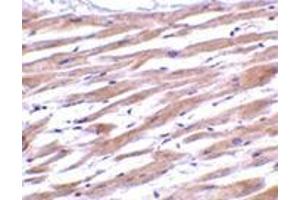 Immunohistochemistry of UNG1 in human heart tissue with this product at 2 μg/ml. (UNG Antikörper  (C-Term))