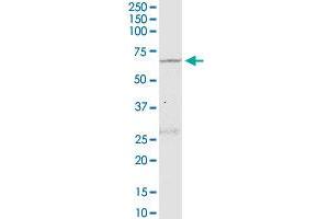NLK monoclonal antibody (M02), clone 2B11. (Nemo-Like Kinase Antikörper  (AA 416-515))