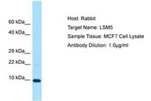 Image no. 1 for anti-LSM5 Homolog, U6 Small Nuclear RNA Associated (LSM5) (C-Term) antibody (ABIN6750056)