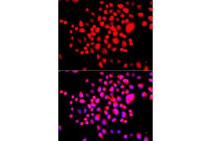 Immunofluorescence analysis of A549 cell using STK19 antibody. (STK19 Antikörper)