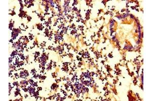Immunohistochemistry of paraffin-embedded human appendix tissue using ABIN7162734 at dilution of 1:100 (PDZD11 Antikörper  (AA 1-140))