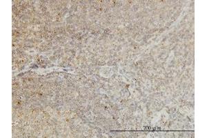 Image no. 1 for anti-Cyclin-Dependent Kinase-Like 4 (CDKL4) (AA 196-295) antibody (ABIN466282) (CDKL4 Antikörper  (AA 196-295))