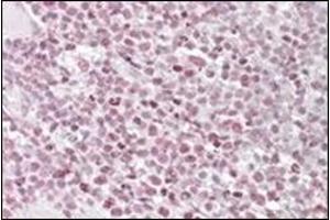 Staining of paraffin embedded Human Tonsil using IKAROS antibody at 1 µg/ml. (IKZF1 Antikörper  (Internal Region))