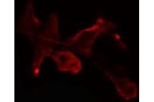 ABIN6275464 staining Hela cells by IF/ICC. (RAB2B Antikörper  (Internal Region))