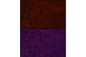 Immunofluorescence analysis of human liver cells using LRG1 Rabbit pAb (ABIN6130528, ABIN6143317, ABIN6143318 and ABIN6223826) at dilution of 1:100 (40x lens). (LRG1 Antikörper  (AA 36-347))