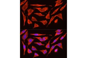 Immunofluorescence analysis of HeLa cells using POMC Rabbit pAb (ABIN3017230, ABIN3017231, ABIN3017232 and ABIN6220004) at dilution of 1:200 (40x lens). (POMC Antikörper  (AA 1-267))