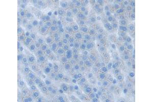 Immunohistochemistry (IHC) image for anti-ATP-Binding Cassette, Sub-Family G (WHITE), Member 8 (ABCG8) (AA 1-271) antibody (ABIN5013204)