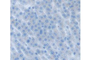 Used in DAB staining on fromalin fixed paraffin- embedded liver tissue (ABCG8 Antikörper  (AA 1-271))