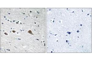 Immunohistochemistry analysis of paraffin-embedded human brain tissue, using BCAR3 Antibody. (BCAR3 Antikörper  (AA 761-810))
