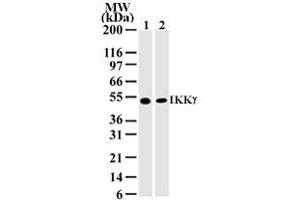 Western Blotting (WB) image for anti-Inhibitor of kappa Light Polypeptide Gene Enhancer in B-Cells, Kinase gamma (IKBKG) antibody (ABIN6655867)