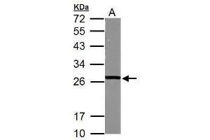 WB Image Sample (50 ug of whole cell lysate) A: mouse brain 12% SDS PAGE antibody diluted at 1:1000 (GSTM5 Antikörper)