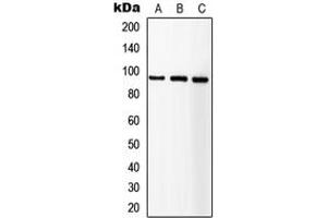 Western blot analysis of IGF1 Receptor expression in HEK293T (A), SP2/0 (B), NIH3T3 (C) whole cell lysates. (IGF1R Antikörper  (C-Term))