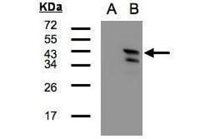 WB Image Western Blot analysis of CAMK1D expression in transfected 293T cell line by CAMK1D polyclonal antibody. (CAMK1D Antikörper)