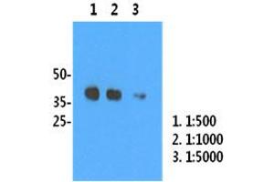 H1N1/HA1 recombinant protein (50ng) were resolved by SDS-PAGE, transferred to PVDF membrane and probed with anti-human H1N1/HA1 antibody (1:500). (Influenza Hemagglutinin HA1 Chain Antikörper (Influenza A Virus H1N1))