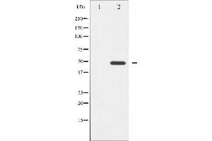 Western blot analysis of GATA4 expression in HeLa whole cell lysates,The lane on the left is treated with the antigen-specific peptide. (GATA4 Antikörper  (Internal Region))