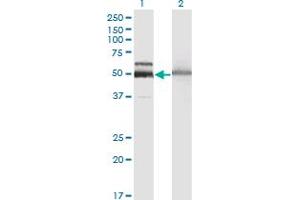 Western Blot analysis of HEXA expression in transfected 293T cell line by HEXA monoclonal antibody (M06), clone 3D1.